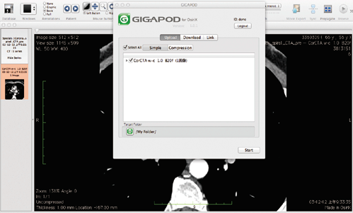 gigapod 4 osirix